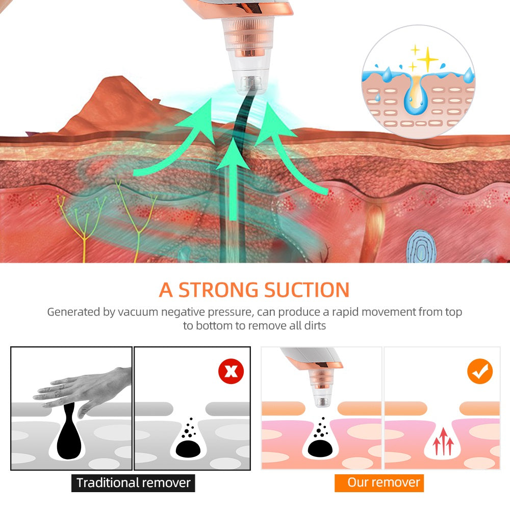 Acne Pore Cleaner & Black Head Remover With Cleaning Tools