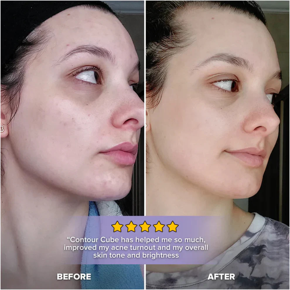 Zylo - Ice Contour Cube