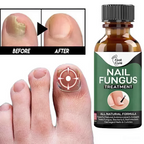 Zylo - Nail Fungal Repair Serum | Nail Fungus Removal Gel