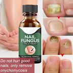 Zylo - Nail Fungal Repair Serum | Nail Fungus Removal Gel