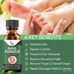 Zylo - Nail Fungal Repair Serum | Nail Fungus Removal Gel